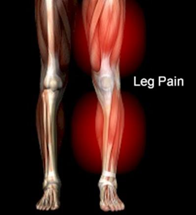 leg pain